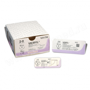 Vicryl - рассасывающийся шовный материал, Ethicon