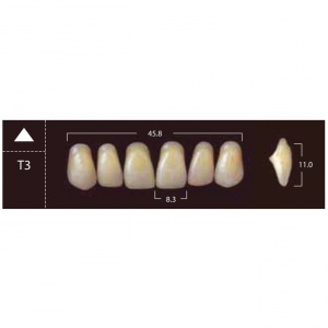 New Ace Anterior - фронтальные верхние, фасон T3 (6шт.) Yamahachi