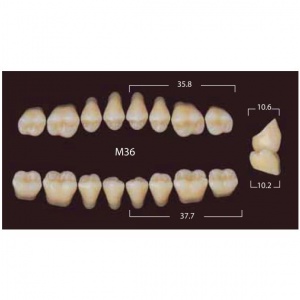 New Million Posterior - 20 боковых гарнитуров в боксе, фасон M36 (320шт.) Yamahachi