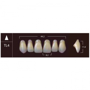 New Ace Anterior - фронтальные верхние, фасон TL4 (6шт.) Yamahachi