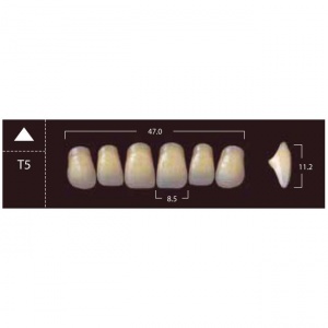 New Ace Anterior - фронтальные верхние, фасон T5 (6шт.) Yamahachi