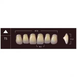 New Ace Anterior - фронтальные верхние, фасон T5 (6шт.) Yamahachi