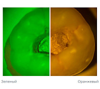 ALLTION AM-5000VFR стоматологический микроскоп с вариоскопом и флуоресцентным режимом (чёрный) — фото товара